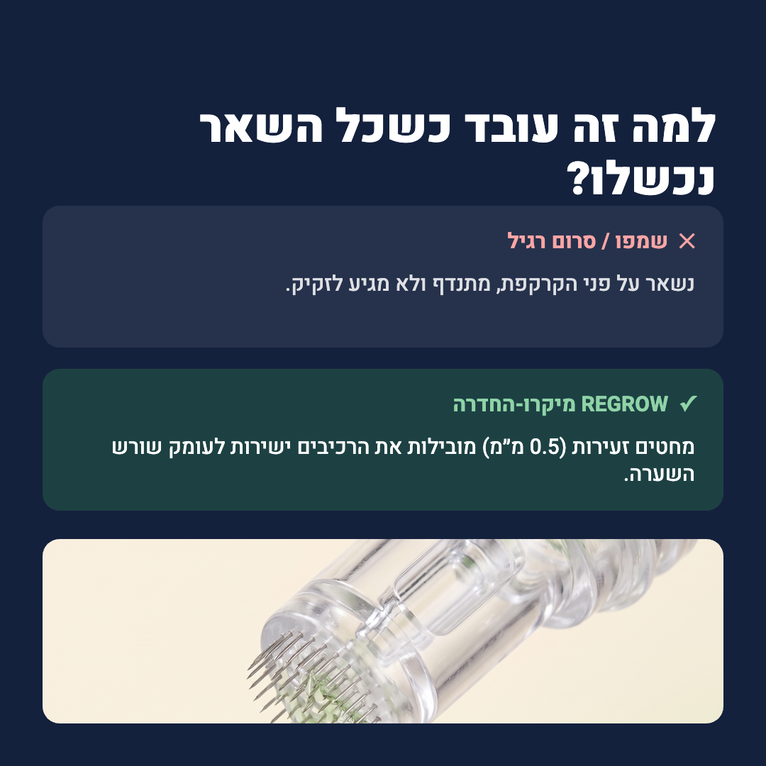 למה זה עובד